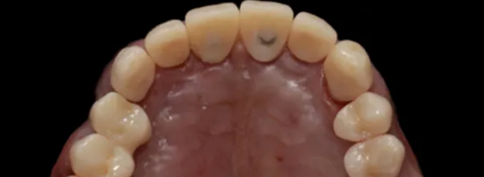 3D Printing in Dentistry: Revolutionizing Dental Care