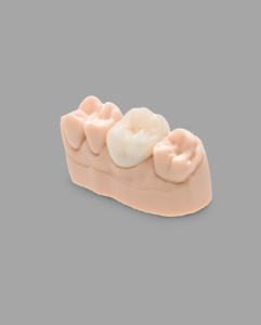 CROWNTEC for NextDent