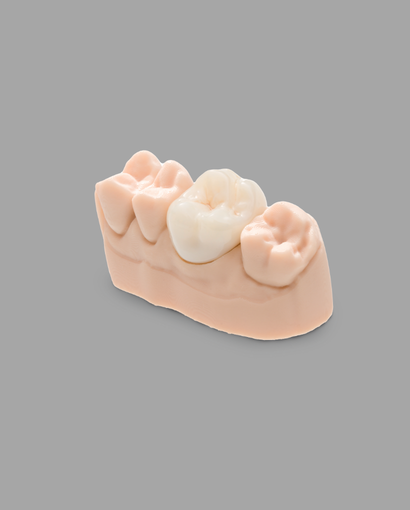 CROWNTEC for NextDent