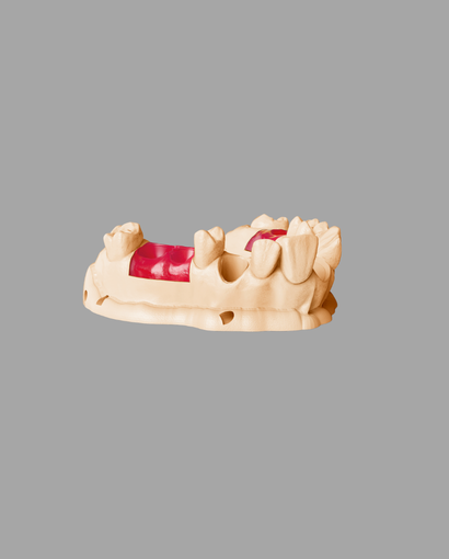 NextDent Gingiva Mask